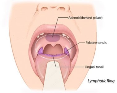 adenoids front view