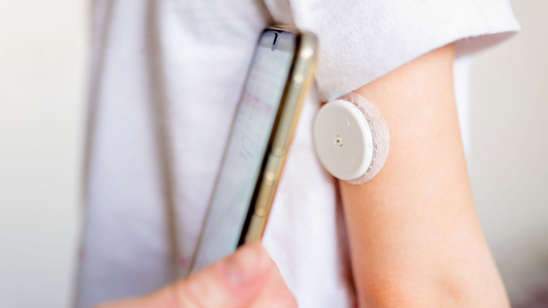 Continuous glucose monitoring device on child