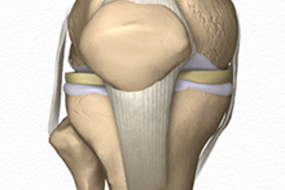 Pediatric Orthopedic Animations