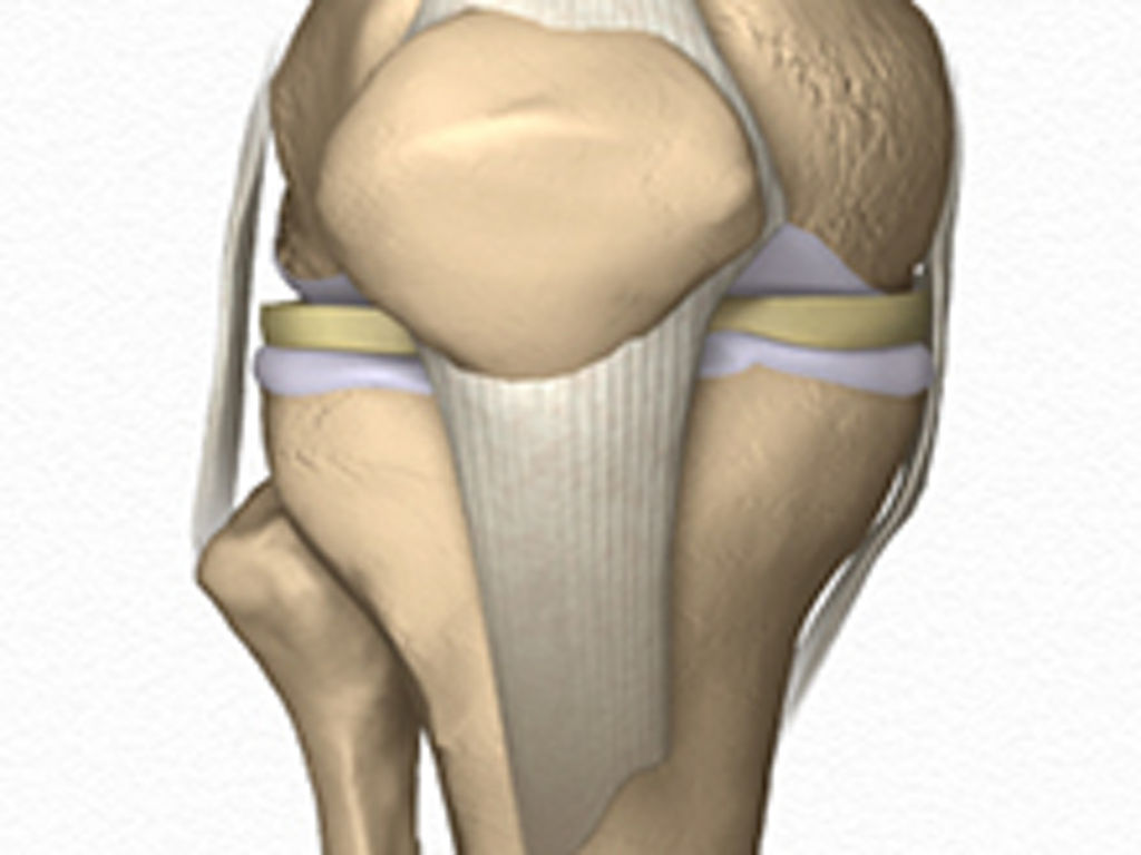 Orthopedic animations